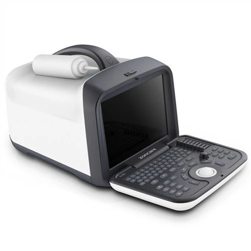 Nivo Antre B&W Jeneral Ultrasound Imaging